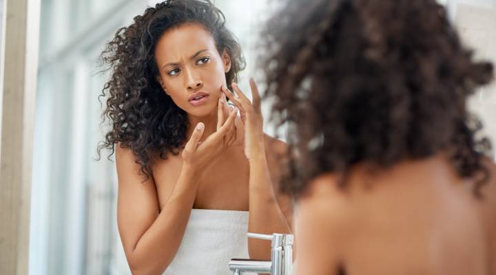 moça verificando acne no espelho
