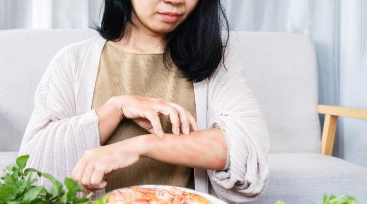 Foto de uma mulher coçando os braços devido a uma alergia alimentar.