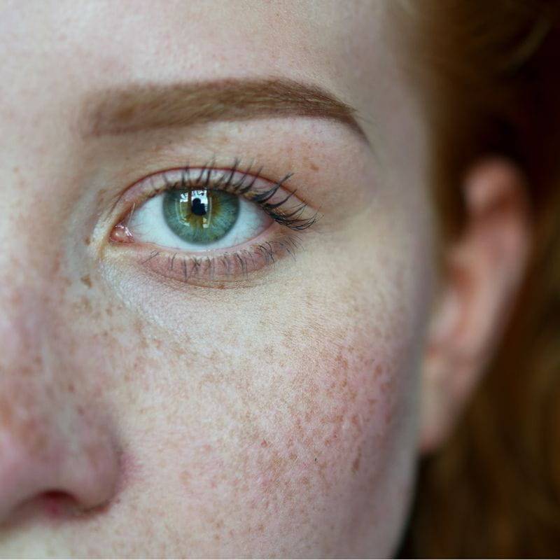 Foto de um rosto de uma mulher ruiva com sardas.