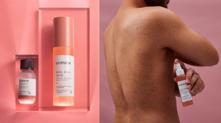 pessoa espirrando body acne em suas costas