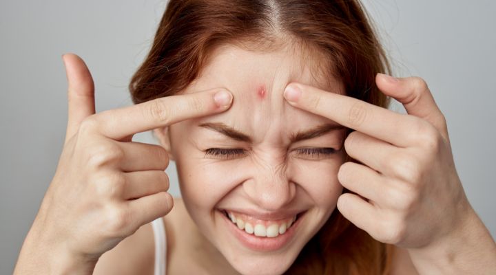 mulher espremendo espinha inflamada no rosto
