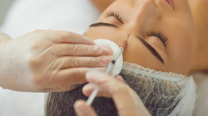aplicando botox na testa