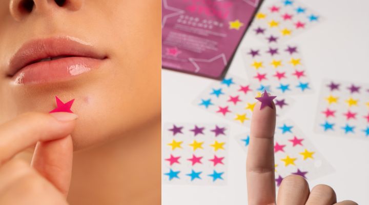 Pele com adesivos de estrela para acne