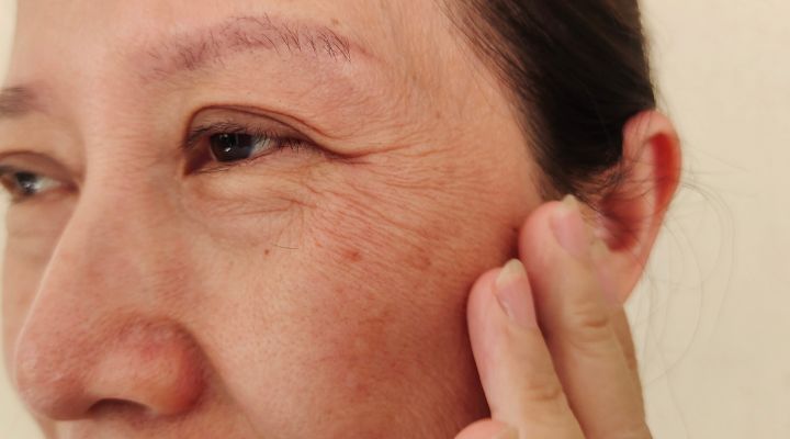 Mulher tocando o rosto, mostrando rugas de expressão.