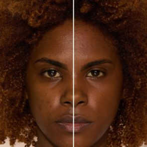 comparacao-pele-tons-texturas